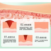 矽膠去疤修復貼 祛疤膏貼 袪疤貼(4cm x 1.5m)疤痕隱藏貼 自由裁剪祛疤貼 祛疤膏貼 剖腹產疤痕貼