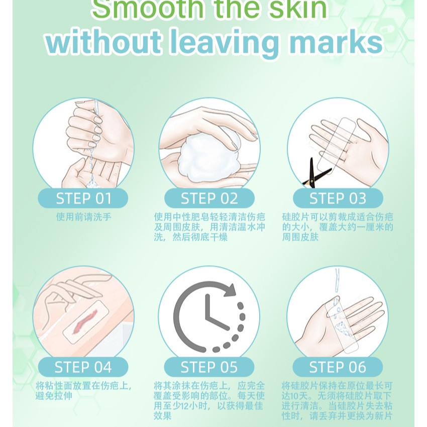 矽膠去疤修復貼 祛疤膏貼 袪疤貼(4cm x 1.5m)疤痕隱藏貼 自由裁剪祛疤貼 祛疤膏貼 剖腹產疤痕貼