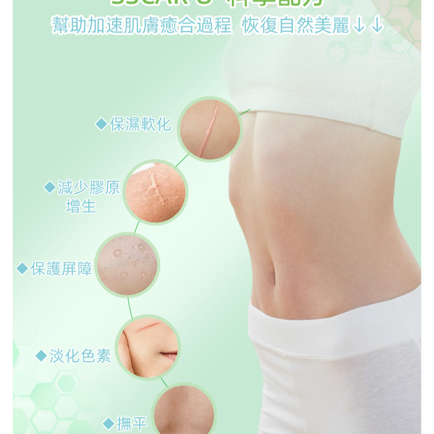 矽膠去疤修復貼 祛疤膏貼 袪疤貼(4cm x 1.5m)疤痕隱藏貼 自由裁剪祛疤貼 祛疤膏貼 剖腹產疤痕貼